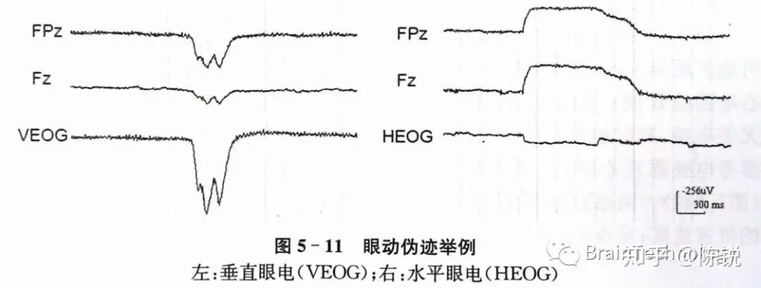 脑电分析之眼电纠正