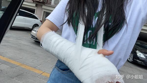 小姐姐舟骨骨折日记