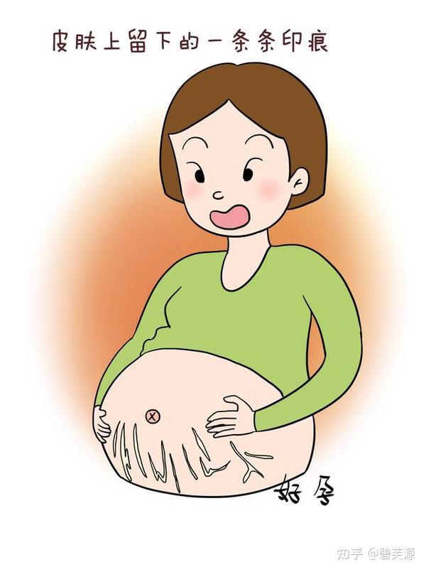 二胎后肚子上长有红色妊娠纹该怎么去除