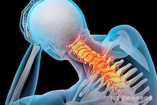 7, 混合型颈椎病:具有前述诸型两种及两种以上颈椎病者,多见于病程久