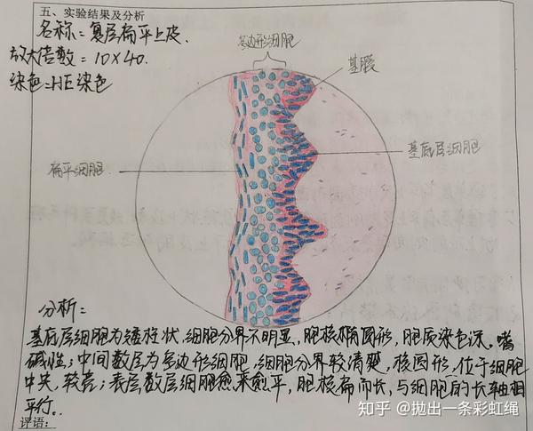 1.复层扁平上皮  (分数:80分)