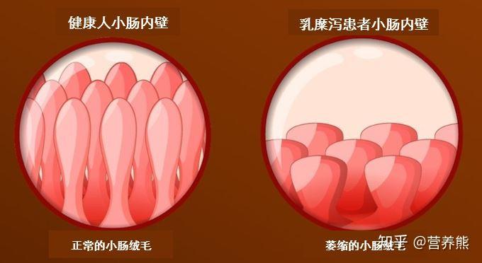 教你分清麸皮麸质与胚芽做饭煲粥加点它健康又好吃