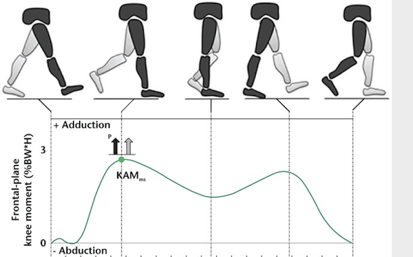 下图中kam显示的是膝盖往里夹的角度(knee adduction moment) 可以