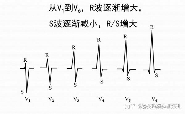 山羊老师心电图机记录要点