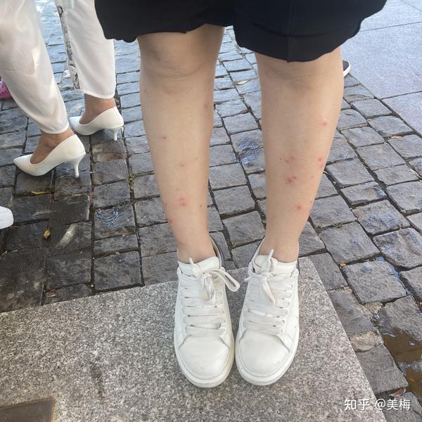 蠓虫小咬槟榔虫
