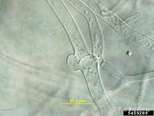 某种担子菌的锁状联合的显微照片.图片来源见水印.