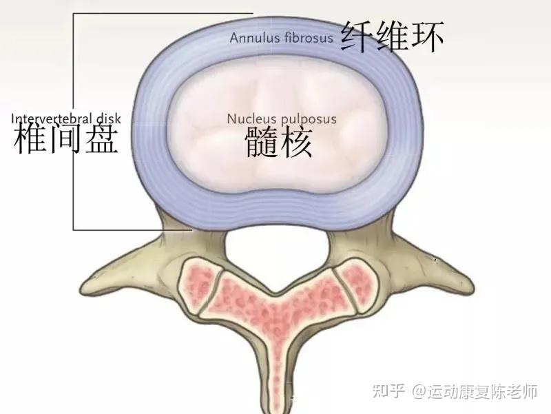 正常椎间盘纤维环破裂1. 盘源性腰痛的常见病因· 肥胖