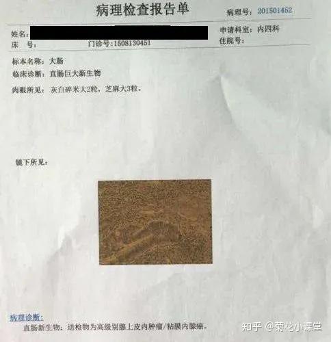 他以为只是普通的痔疮没想到竟然是三期肠癌