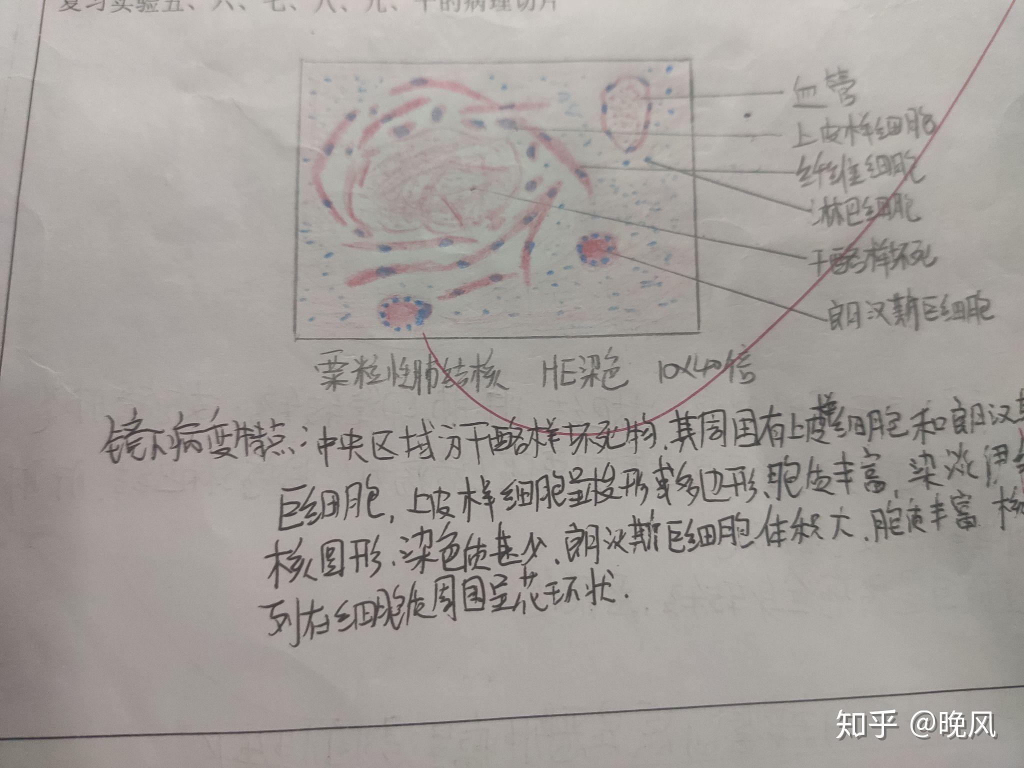 病理学红蓝绘图