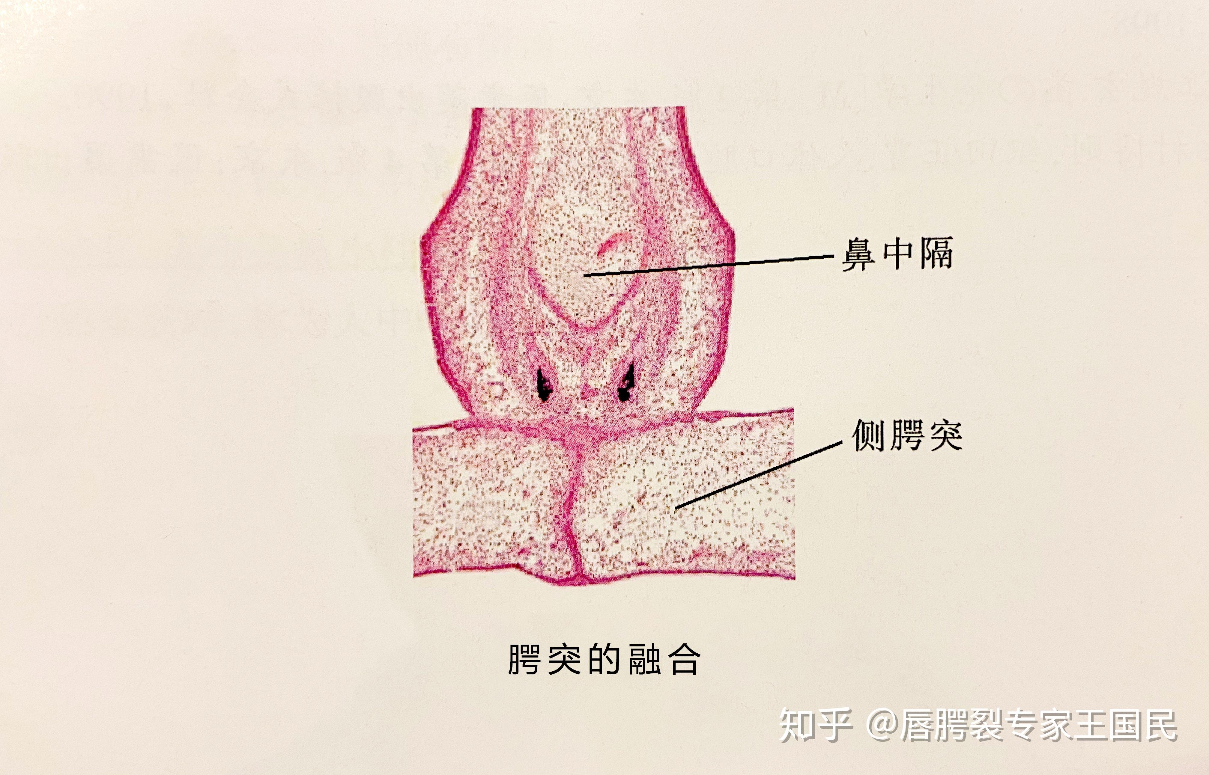 颌面部的胚胎发育之腭部的发育