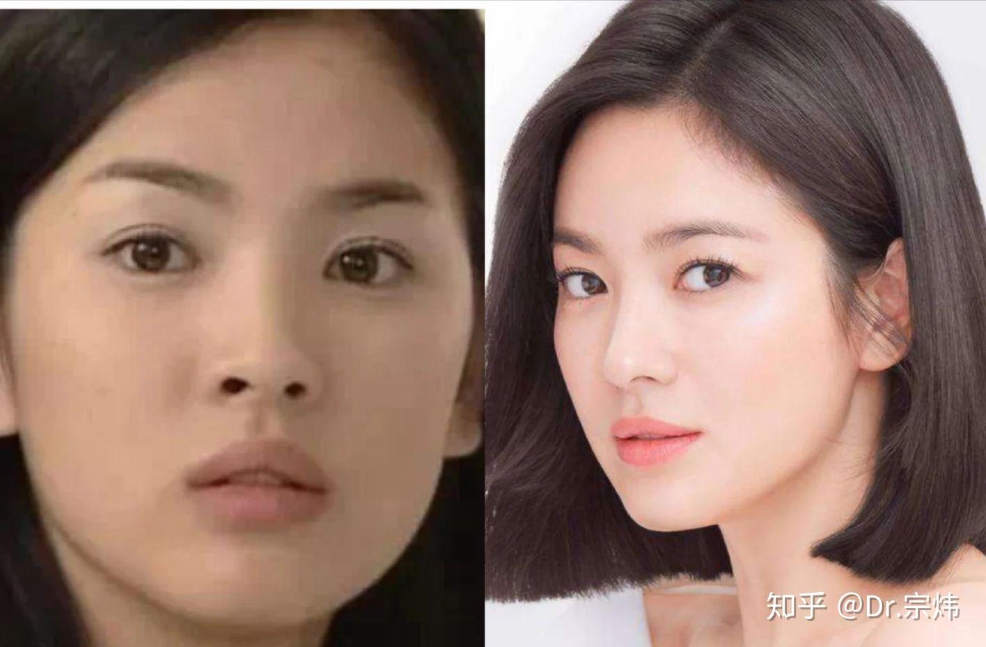 冻龄女神宋慧乔的变美进化史