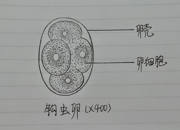 虫卵特点:卵壳外有一层凹凸不平的蛋白质膜) 蛲虫卵镜下图示: 钩虫卵