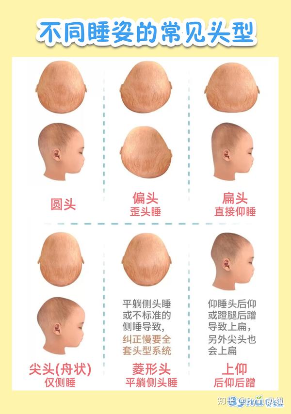 宝宝正确睡姿如何睡出完美头型?