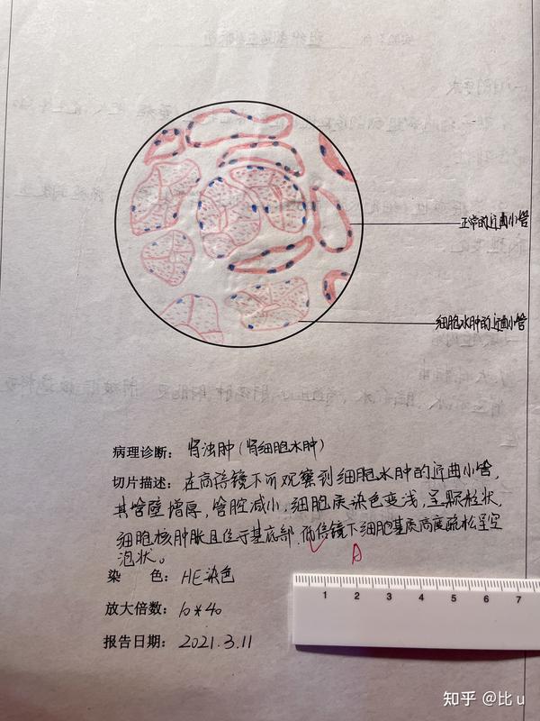 病理学实验绘图红蓝铅笔