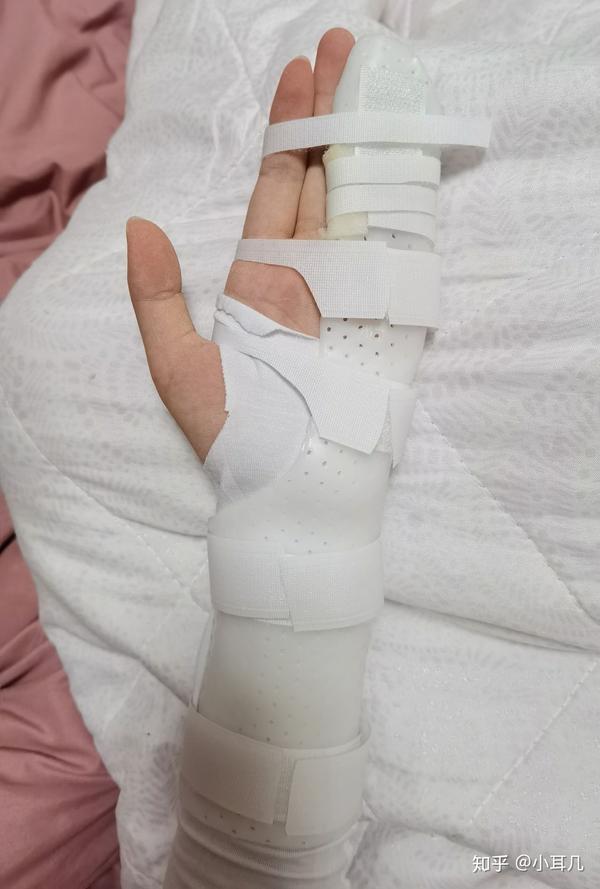 手部神经损伤之求医篇