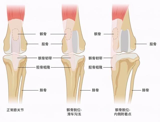 狗狗髌骨脱位的原因是什么应如何治疗