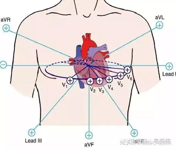 将探查电极置于胸壁不同部位,负极与中心电端相连,就构成胸导联.