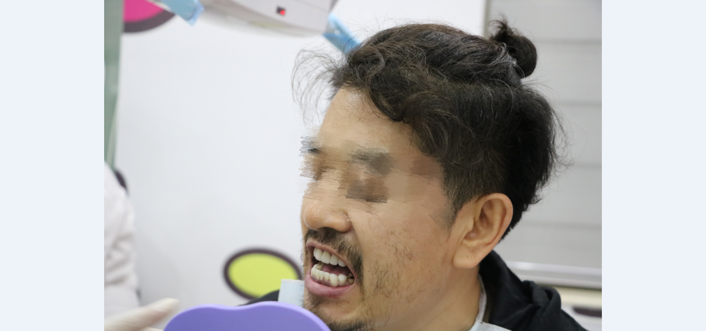 侯先生的种牙故事:一开始龋齿被无视,直到牙齿缺失就后悔了!