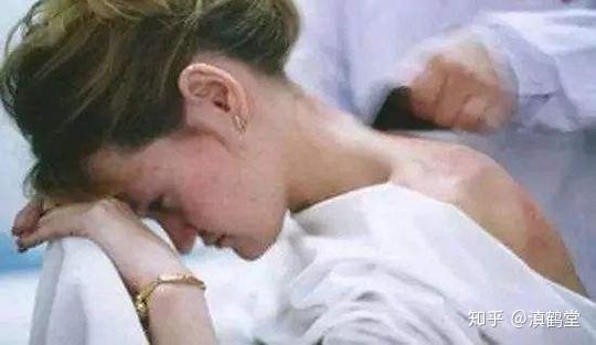 别小看刮痧:刮痧虽好但并非人人适用