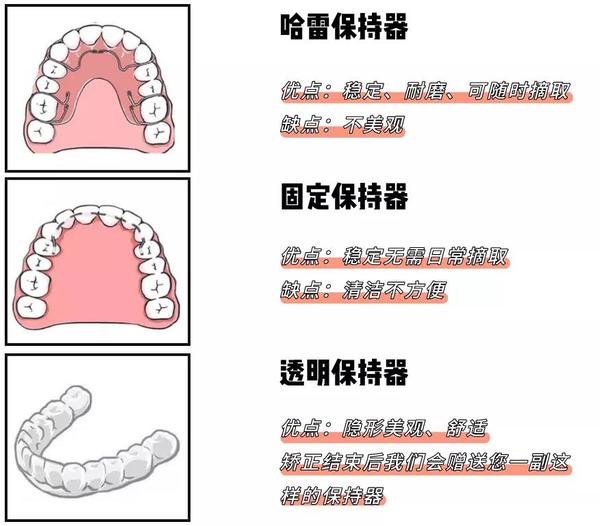 要想牙齿矫正效果好,保持器必不可少