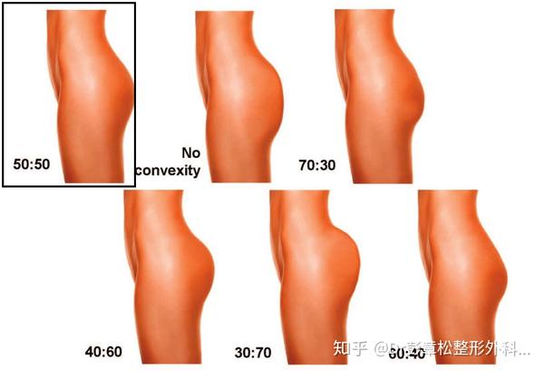 图9 1,从后视角看,臀部上下的比例在70:30比较符合亚洲女性的审美(图