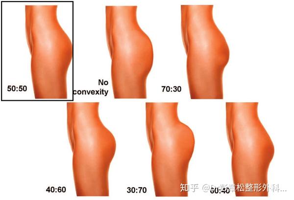 图10 2,从侧面看,臀部上下的比例在50:50比较符合亚洲女性的