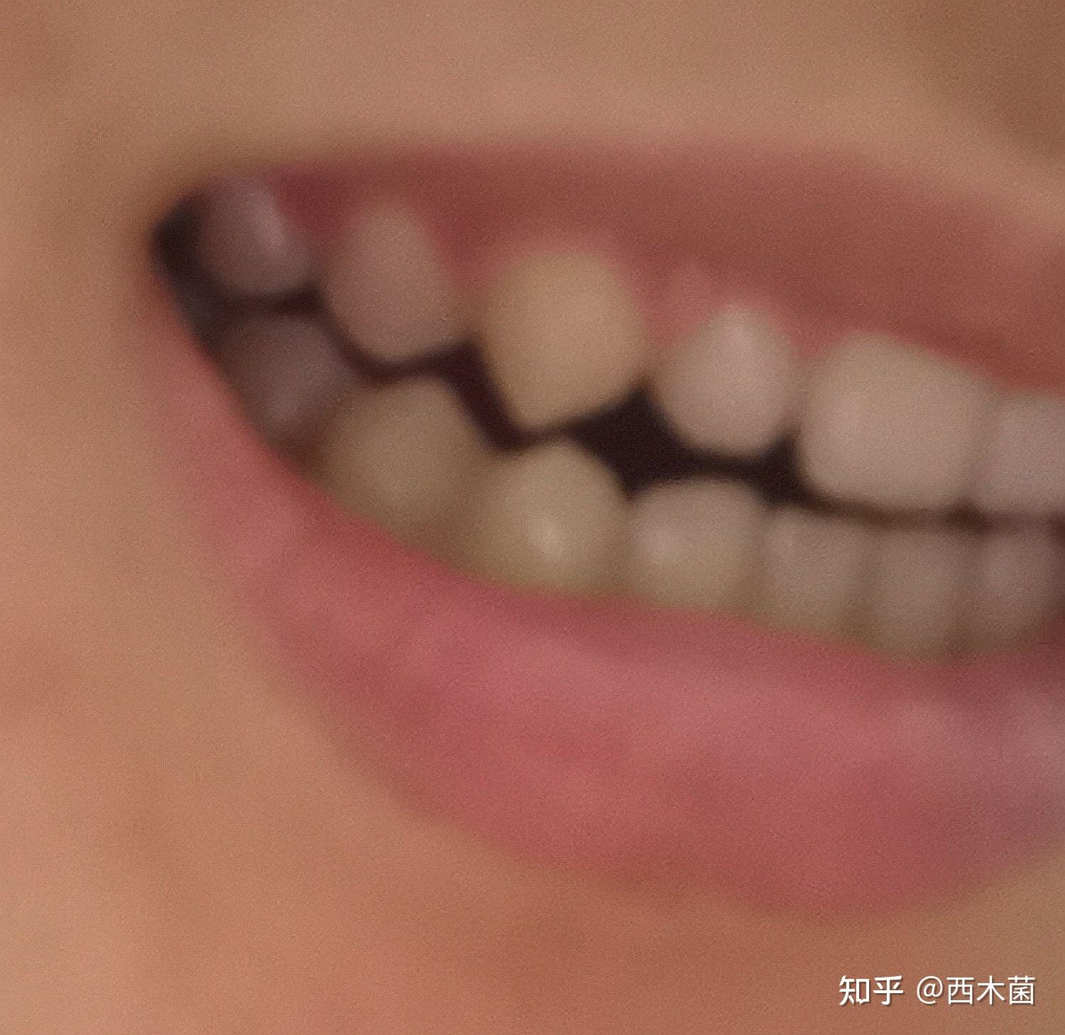有鲨鱼齿是一种怎样的体验