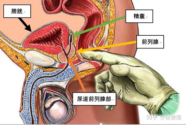 前列腺是男性重要的 性附属器官,正常的前列腺就像是一颗倒置的 栗子