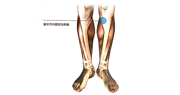 怎样改善鹅足炎