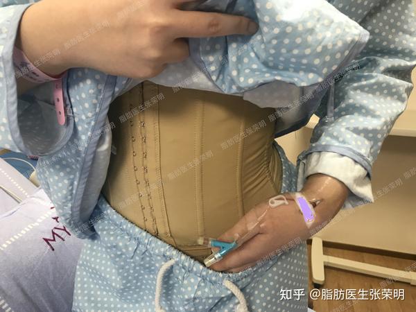 吸脂和溶脂针有什么区别?