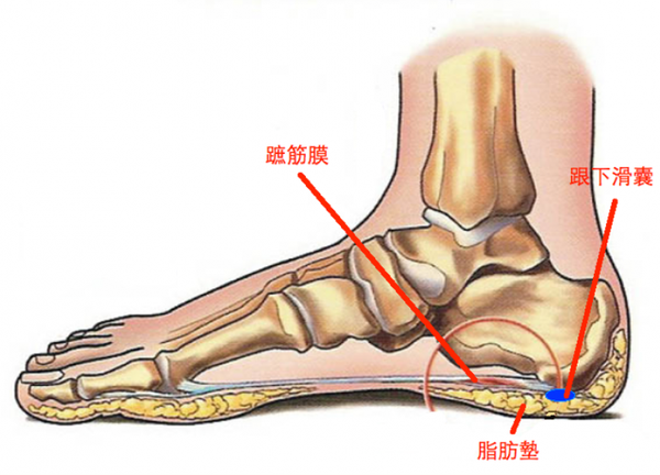 该怎么告别足跟痛