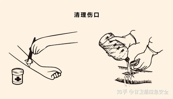 伤口处理是一门很讲究的应急救援实用技能