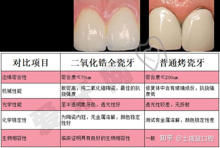 2016年上海补牙做牙套的价格是多少