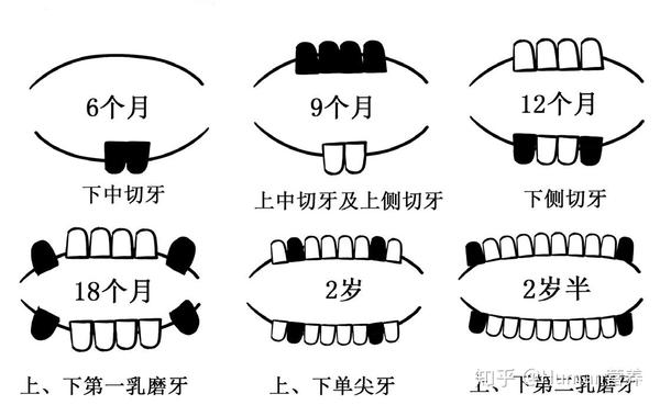 (2)乳牙萌出顺序 乳牙萌出遵循先下后上,自前向后的顺序,大致顺序为