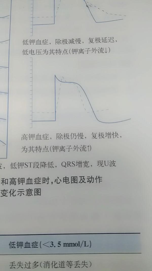 为什么高钾血症会引起有效不应期缩短