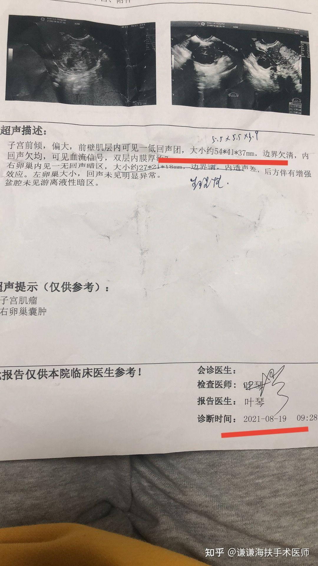 子宫肌瘤海扶刀治疗后三个月随访