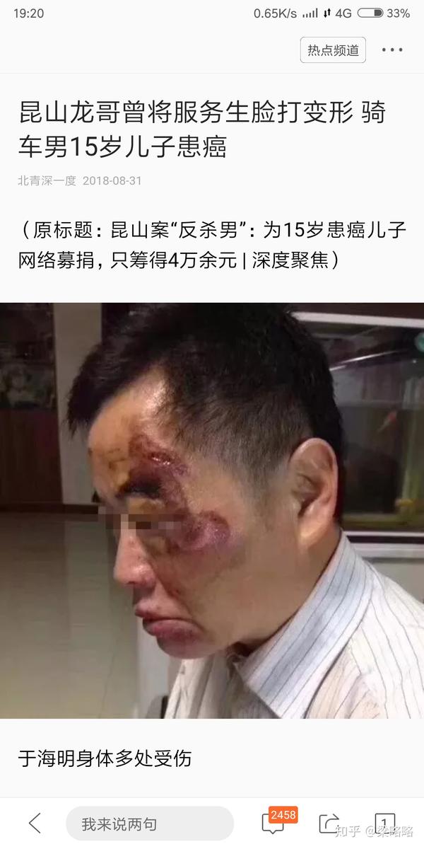 如何看待昆山震川路龙哥砍人被反杀事件?被砍男子行为