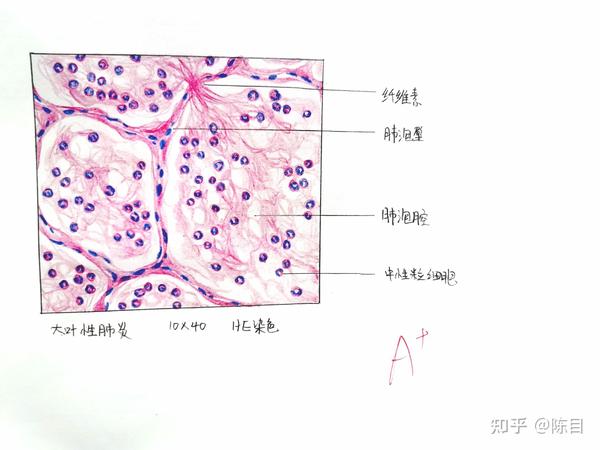 病理红蓝铅笔绘图