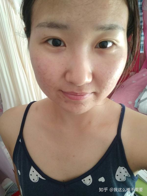 早上起来脸都没洗 皮肤不好 还满脸油光