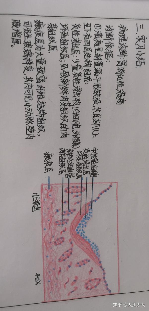 胃消化性胃溃疡