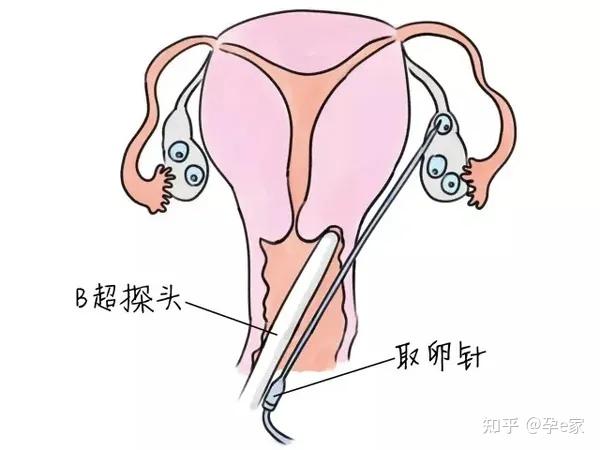 高龄试管必读!30 女性最关心的问题都在这了