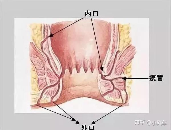肛瘘的症状