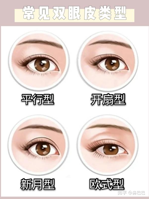 常见的双眼皮类型有:平行双眼皮,开扇形双眼皮,平扇形双眼皮,新月型