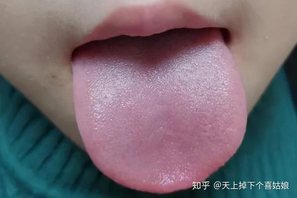 正常的舌苔我们称之为 "淡红舌,薄白苔".