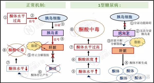 别再分不清营养性生酮和酮症酸中毒了!