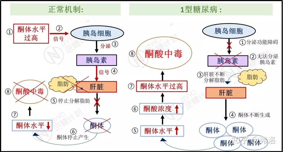 别再分不清营养性生酮和酮症酸中毒了