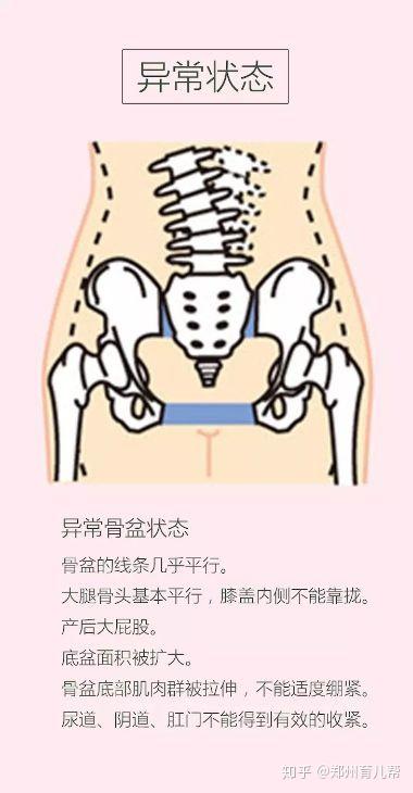 如图所示,耻骨联合处疼痛,会有明显压痛,单侧下肢不能负重,行走无力