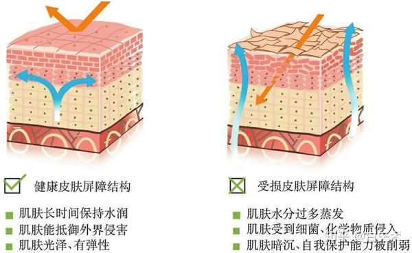 健康皮肤屏障结构,受损皮肤屏障结构对比图