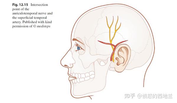 耳颞神经常与颞浅动脉伴行 图片来源: migraine surgery  thomas