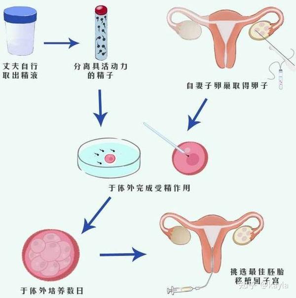 夏天天气热做试管婴儿会影响成功率吗